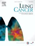 Lung Cancer Journal